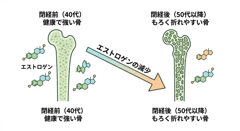50代を境に、女性ホルモン(エストロゲン)の減少とともに健康な骨が骨粗しょう症へ変化していくイメージ図。左が40代、右が閉経後の骨密度低下を示すインフォグラフィック。